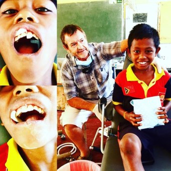 JM and fractured incisors